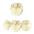Dental Crowns Dental Bridges